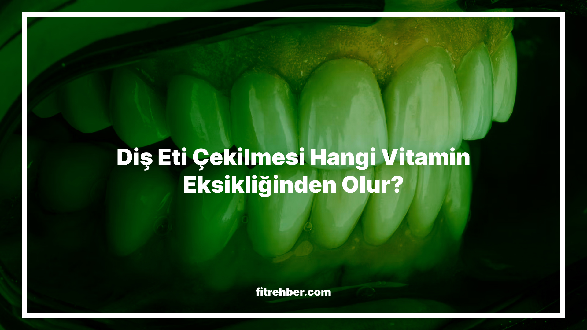 Diş Eti Çekilmesi Hangi Vitamin Eksikliğinden Olur?