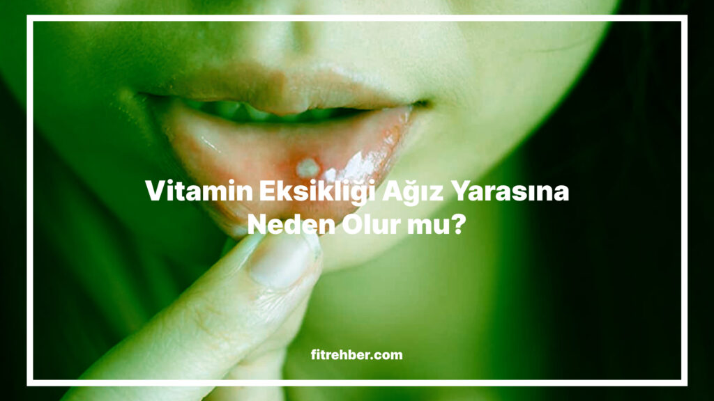 Ağız Yarası Hangi Vitamin Eksikliğinden Olur?